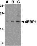 4E-BP1 Antibody