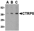CTRP5 Antibody