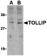 TOLLIP Antibody