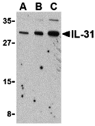 IL-31 Antibody