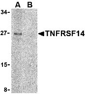 TNFRSF14 Antibody