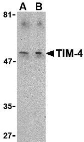TIM-4 Antibody
