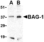 BAG-1 Antibody