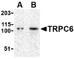 TRPC6 Antibody