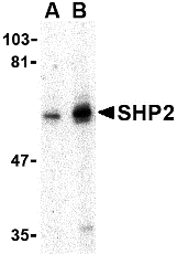 SHP2 Antibody