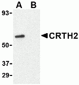 CRTH2 Antibody