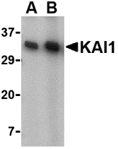 KAI1 Antibody