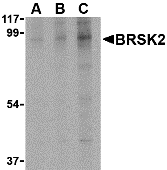BRSK2 Antibody
