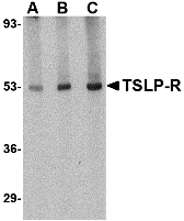TSLP Receptor Antibody