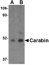 Carabin Antibody
