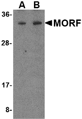 MORF4 Antibody