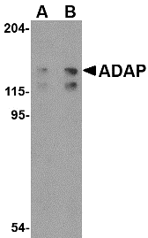 ADAP Antibody