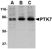 PTK7 Antibody
