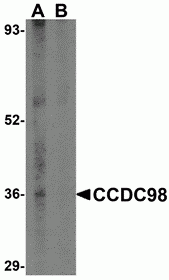 CCDC98 Antibody
