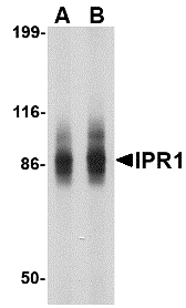 IPR1 Antibody
