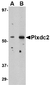 Plxdc2 Antibody