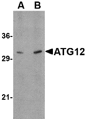 ATG12 Antibody
