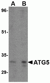 ATG5 Antibody