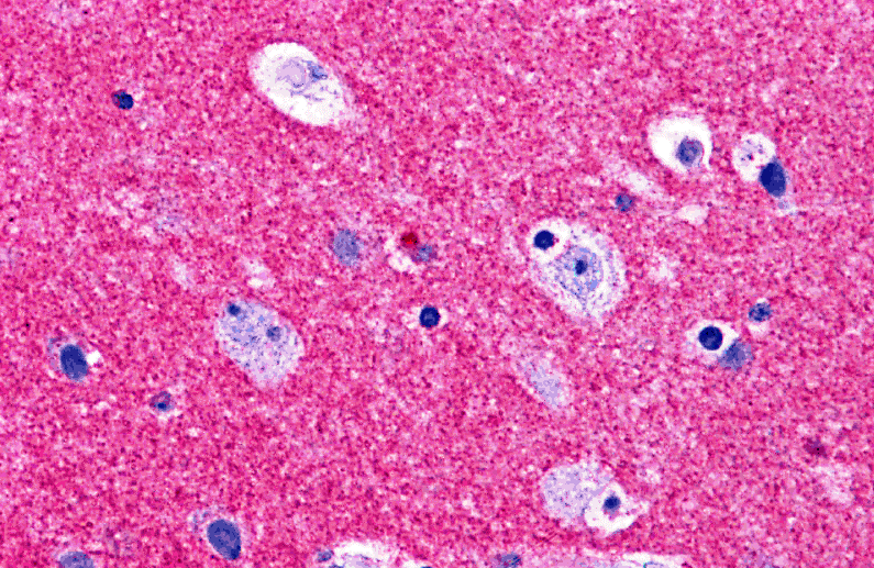 RIM2 Antibody
