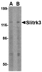 Slitrk3 Antibody