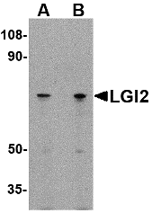 LGI2 Antibody