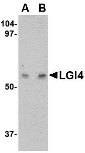 LGI4 Antibody