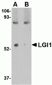 LGI1 Antibody