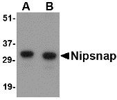 NIPSNAP Antibody