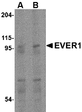 EVER1 Antibody
