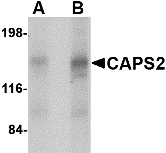 CAPS2 Antibody