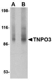 TNPO3 Antibody