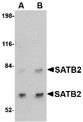 SATB2 Antibody