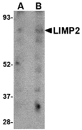 LIMP2 Antibody