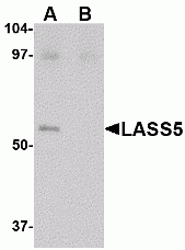 LASS5 Antibody