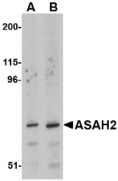 ASAH2 Antibody