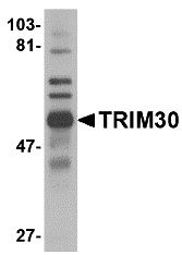 TRIM30 Antibody