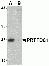PRTFDC1 Antibody