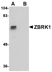 ZBRK1 Peptide