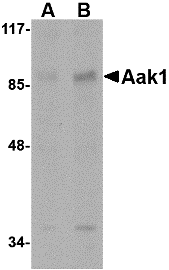 Aak1 Antibody