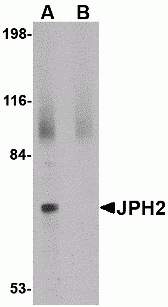 JPH2 Antibody