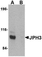 JPH3 Antibody