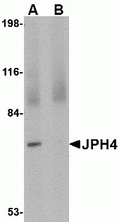 JPH4 Antibody