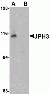 JPH3 Antibody