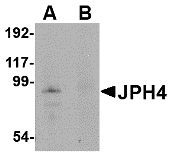 JPH4 Antibody