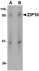 ZIP10 Antibody