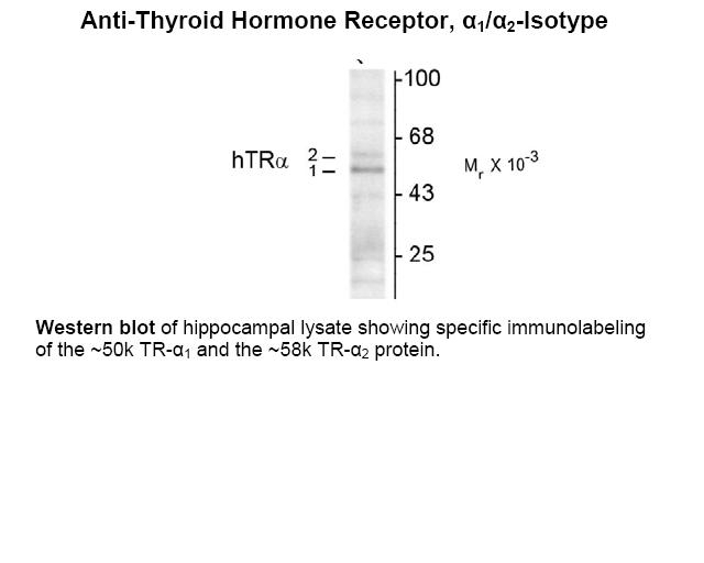 Thyroid Hormone Receptor Antibody [2103]