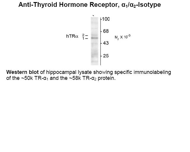 Thyroid Hormone Receptor Antibody [1718]