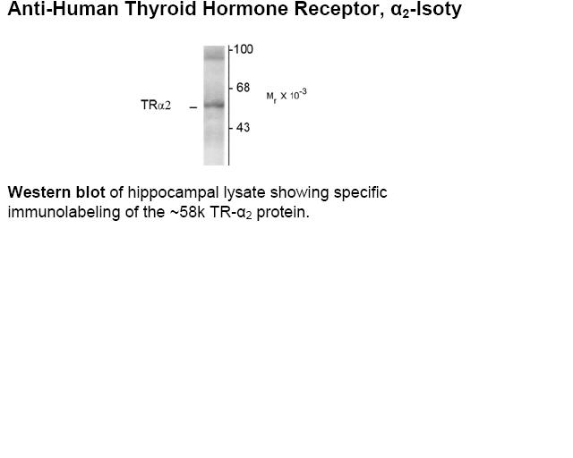 Thyroid Hormone Receptor Antibody [1330]