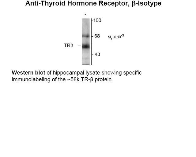 Thyroid Hormone Receptor Antibody [2386]