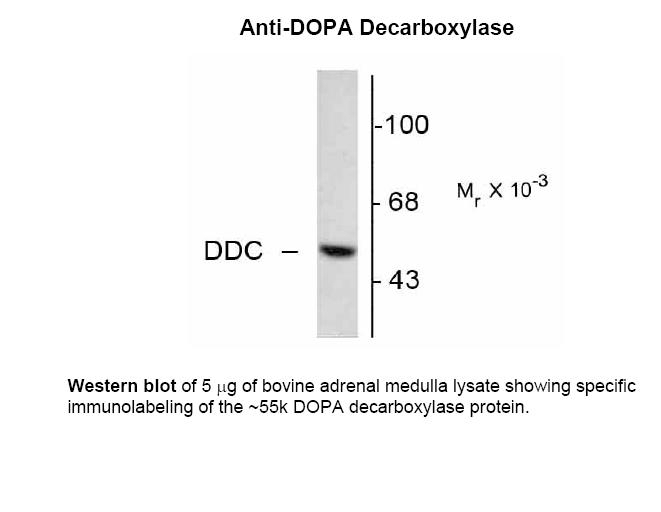 DOPA Decarboxylase Antibody